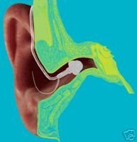 OVET THE EAR HEARING AID INSIDE EAR