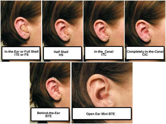 COMPARIOSN OF HEARING AID TYPES