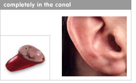COMPLETELY IN CANAL(CIC) HEARING AID